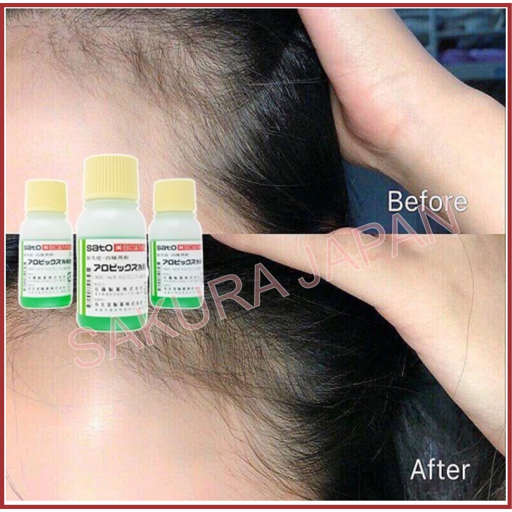 Tinh chất kích thích mọc tóc thảo dược Sato Nhật Bản 30ml giúp kích thích mọc tóc giảm rụng tóc