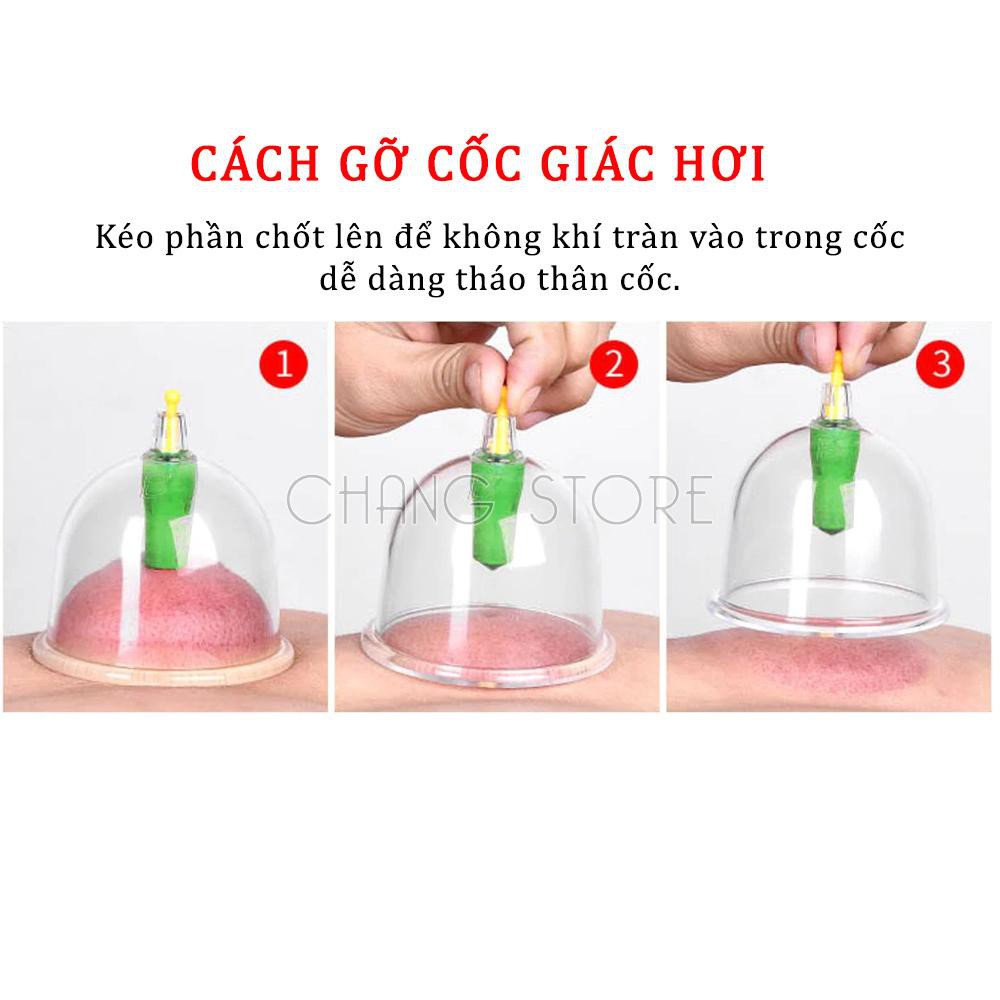 Bộ Giác Hơi Không Dùng Lửa 12 Cốc Tiện Dụng