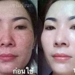 BỘ NÁM CAO CẤP THÁI LAN