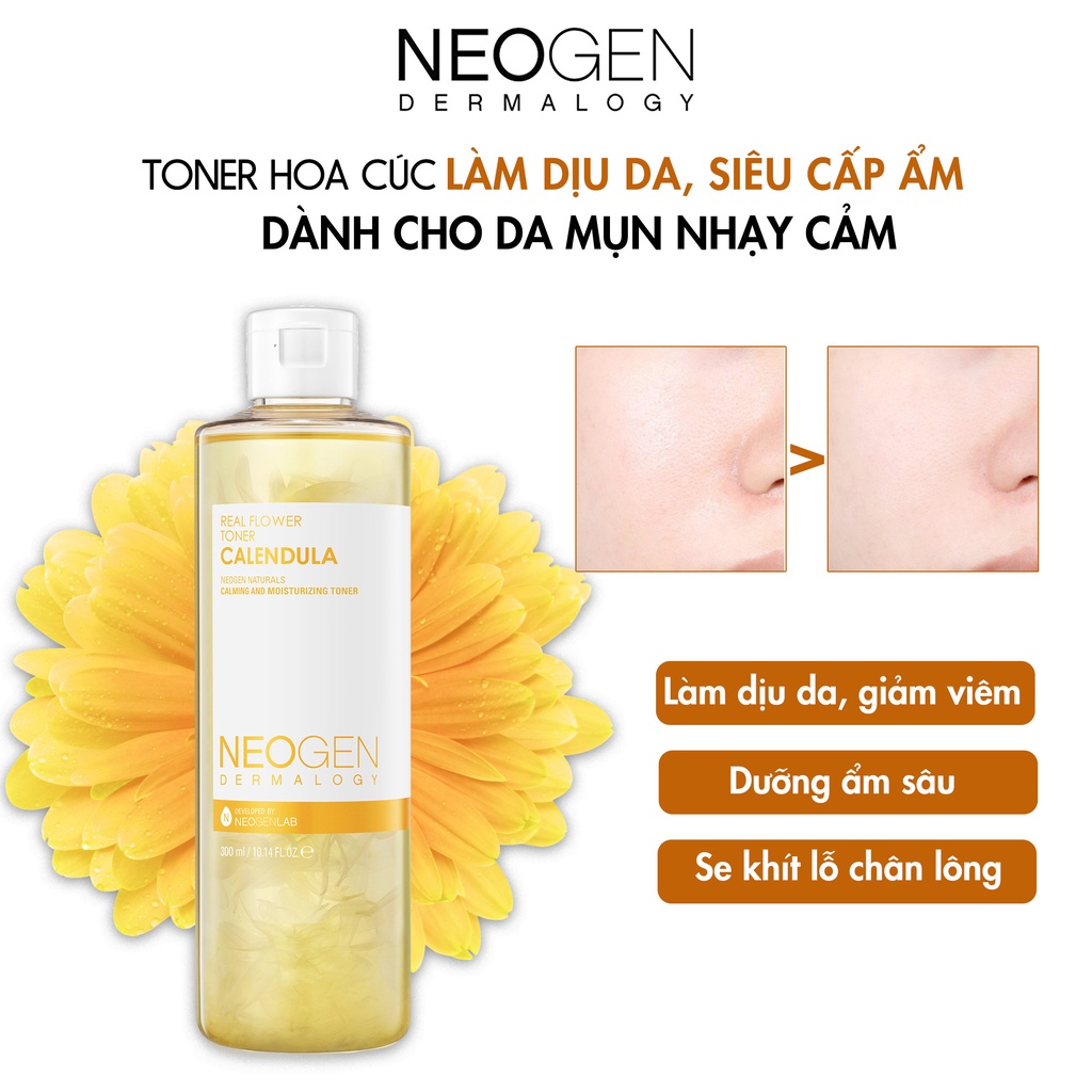 Toner Hoa Cúc Làm Dịu Da, Siêu Cấp Ẩm Cho Da Mụn Neogen Dermalogy Real Flower Toner CALENDULA 300ml