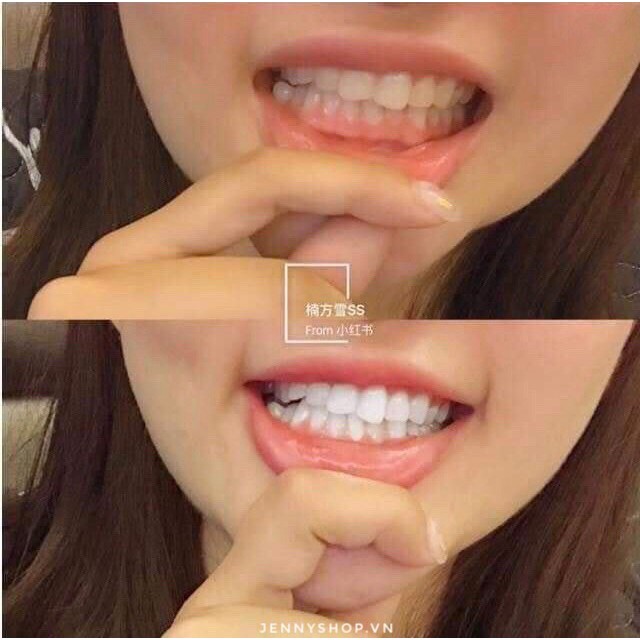 Kem Đánh Răng Median Dental IQ Toothpaste 93%