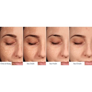 Chấm Eucerin Spotless Brightening 5ml