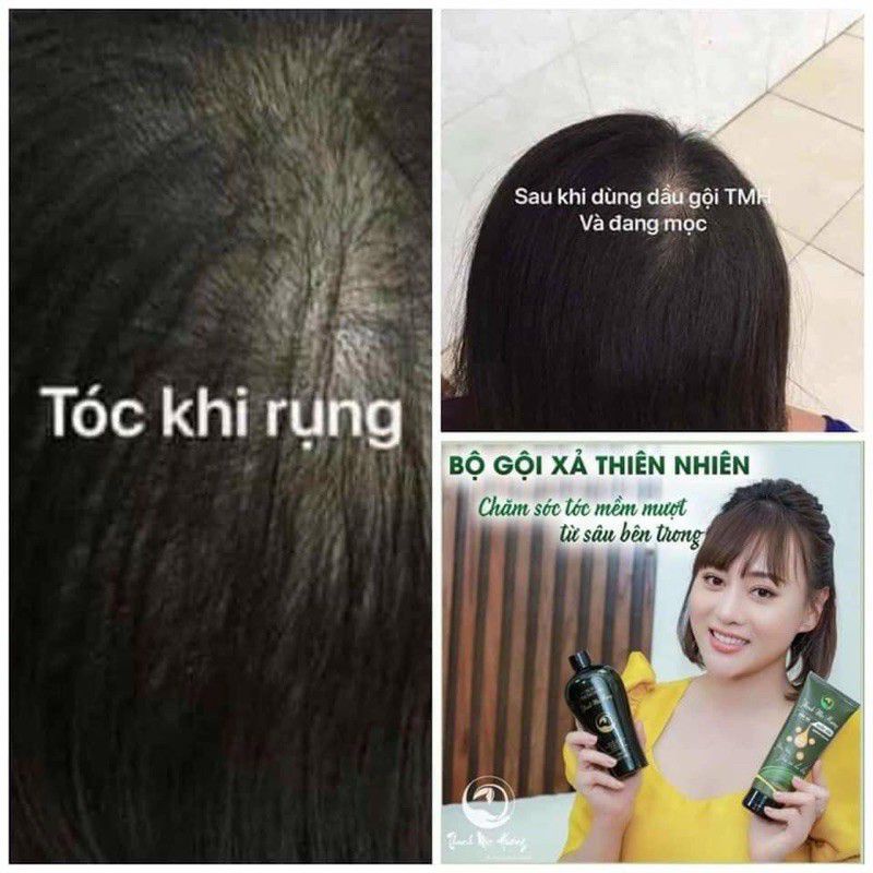 Bộ Dầu Gội Xã Dân Gian Thanh Mộc Hương[100% chính hãng]