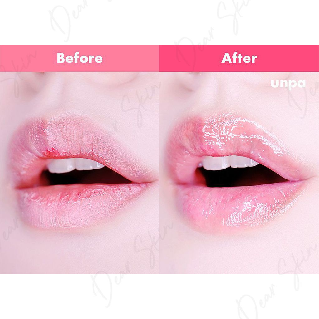 Mặt Nạ Ngủ Môi Unpa Bubi Bubi Lip Mask 9gr