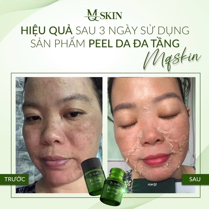 Tái tạo da sinh học đa tầng MQ SKIN