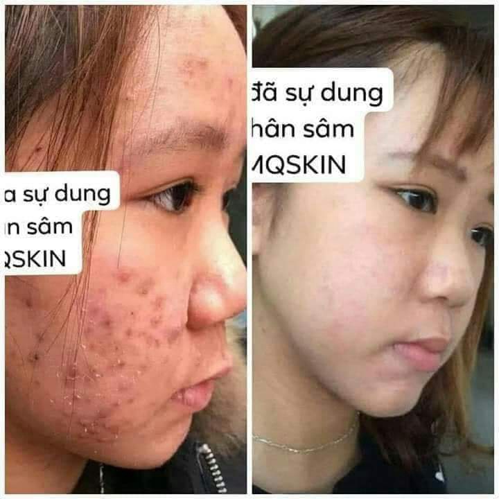 Combo 3 Chai Serum Tái Tạo Da Sâm Cao Rừng MQ SKIN