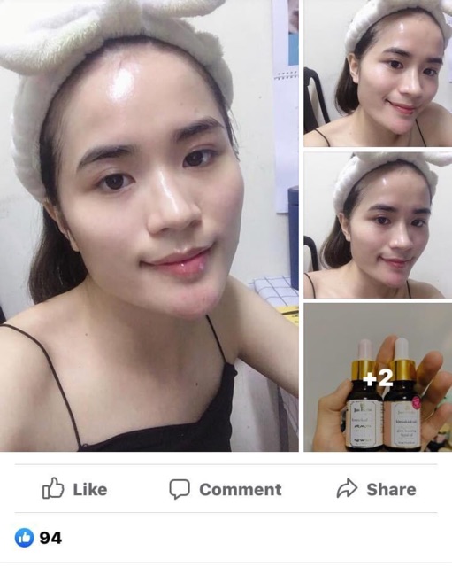 Dầu dưỡng ngăn ngừa và giảm thâm sáng mịn da nghệ tây kimsukadi tail Just herbs Ấn Độ - Chính hãng