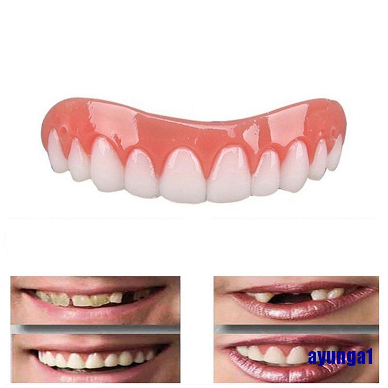 Răng Giả Thuận Tiện