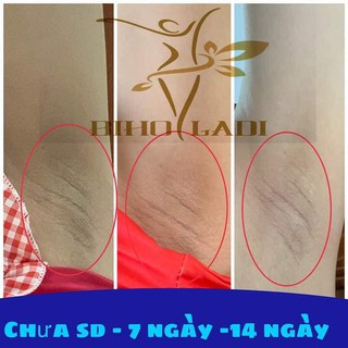 Siêu Dưỡng Thâm 5S
