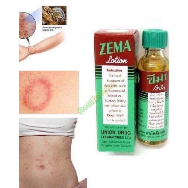 Thoa da zemalotion thái lan