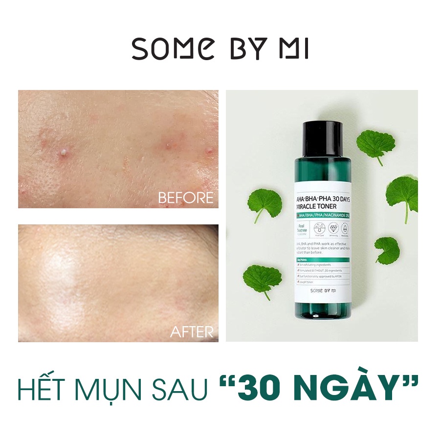 Nước Hoa Hồng SOME BY MI Cho Da Mụn Miracle Toner AHA- BHA-PHA 30 Days Toner 150ml