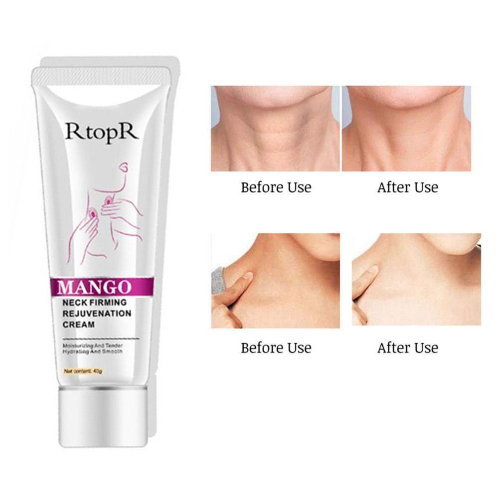 [Hàng mới về] Kem dưỡng da vùng cổ làm săn chắc da chống nếp nhăn RtopR