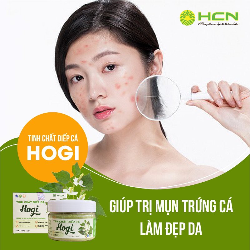 [CHẤT LƯỢNG SỐ 1] Tinh Chất Diếp Cá Hogi Hộp 150gr Giúp Da Trắng Hồng | BigBuy360 - bigbuy360.vn