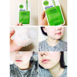 MẶT NẠ MEDIHEAL MASK EXMờ ThâmLoại Mụn Đầu ĐenChống Lão HoáDưỡng ẨmKiềm Dầu