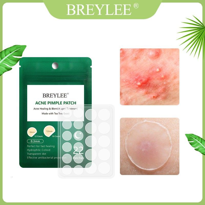 (Hàng Mới Về) Miếng Dán Trị Mụn Trứng Cá Ban Đêm Tiện Dụng | BigBuy360 - bigbuy360.vn