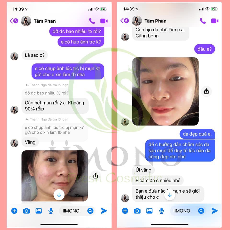 Giảm thâm mụn, bộ sản phẩm giảm mụn tinh chất thiên nhiên IIMONO | BigBuy360 - bigbuy360.vn