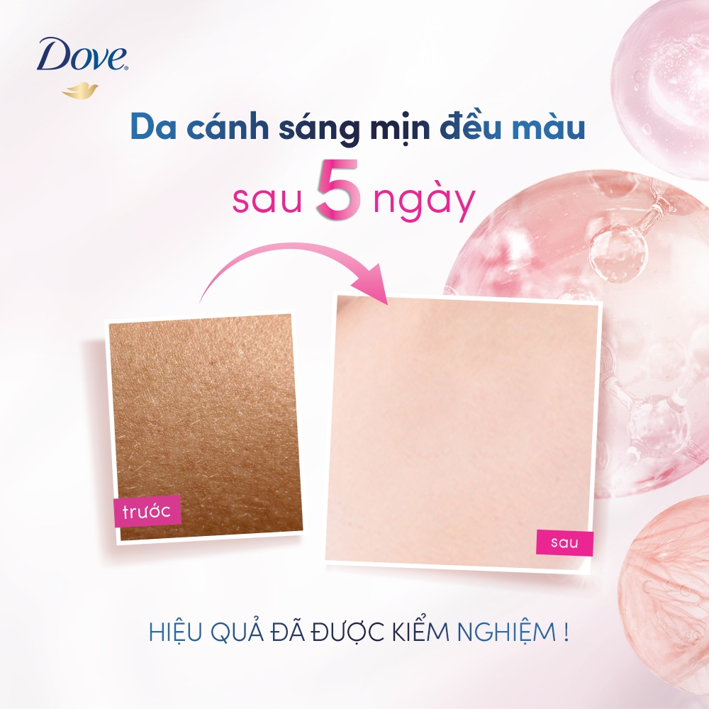 Lăn ngăn mùi dưỡng sáng cao cấp Dove tinh chất serum dành cho nữ với 3% Niacinamide giúp da sáng mịn đều màu 45ml