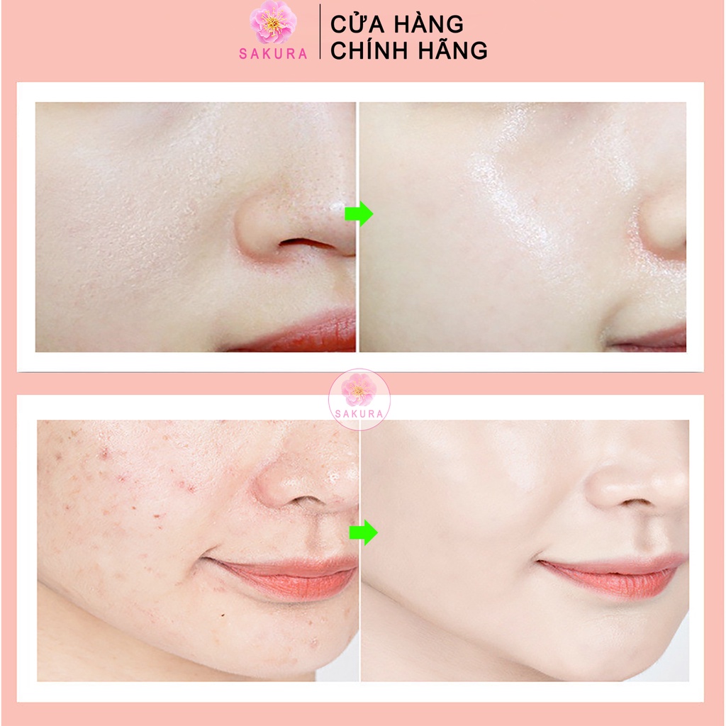 Mặt nạ nhau thai cừu Mask dưỡng ẩm cấp nước trắng da chống lão hoá bổ sung collagen tế bào gốc Nhật Bản SAKURA 40ml