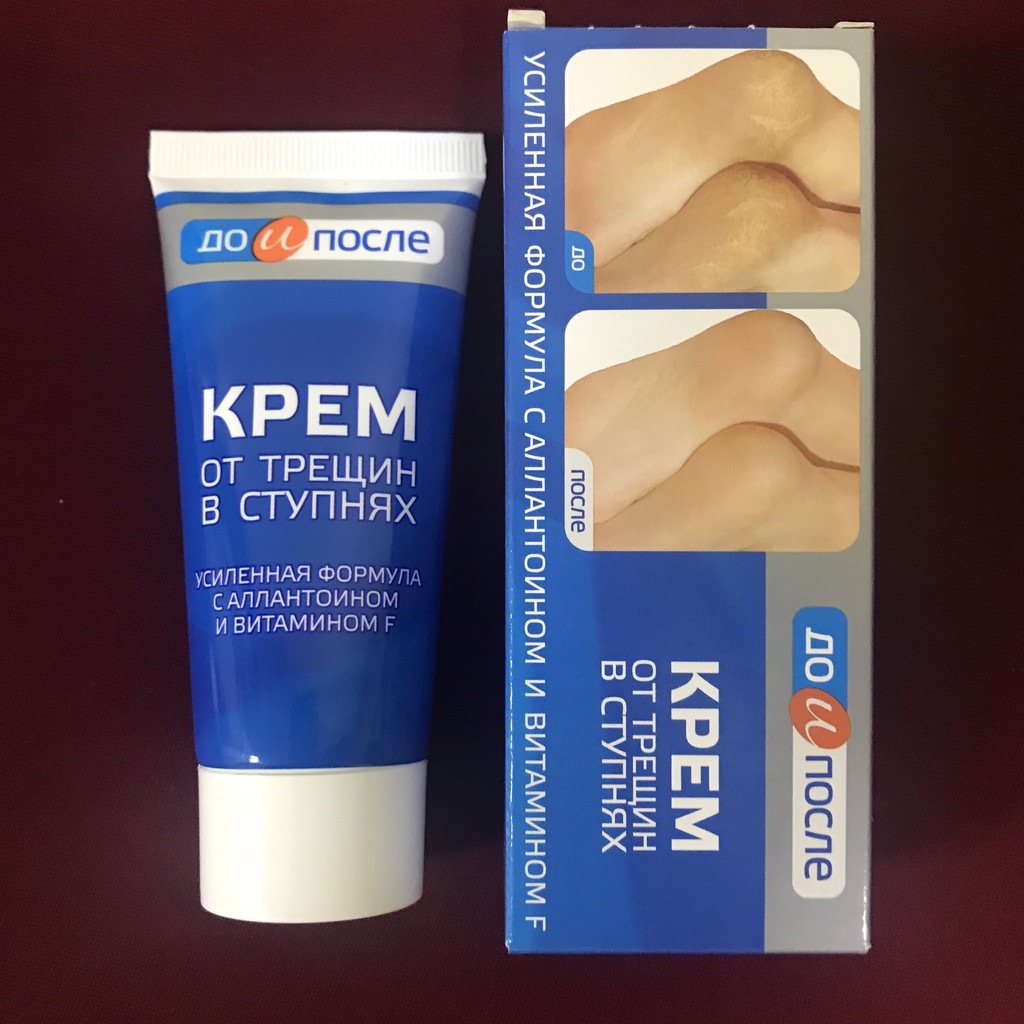 [SALE] [CAM KẾT 100% CHÍNH HÃNG] Kem giảm nứt gót chân KPEM Nga 50ml cung cấp độ ẩm, mau lên da non gót chân