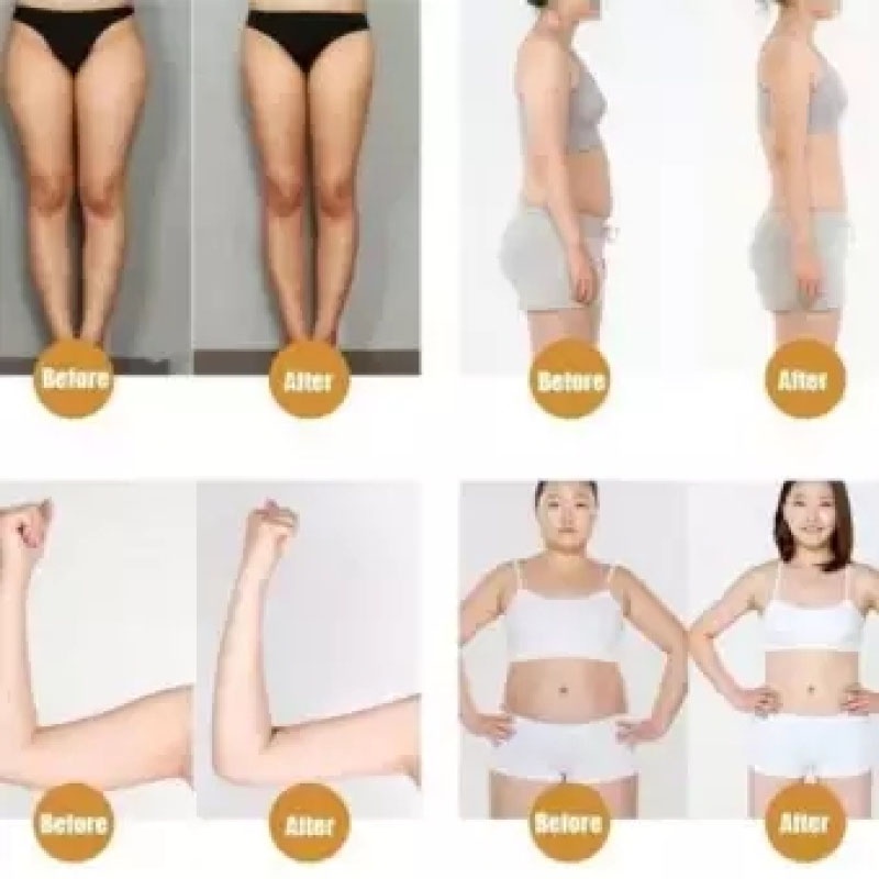 [Mua 2 giảm 4%] 10 Patch Dán Giảm Cân Dán Rốn Tan Mỡ Trung Y Slimming Patch