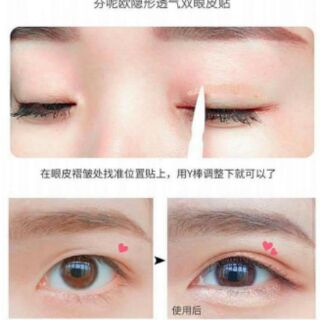 Cuộn 300 miếng dán kích mí