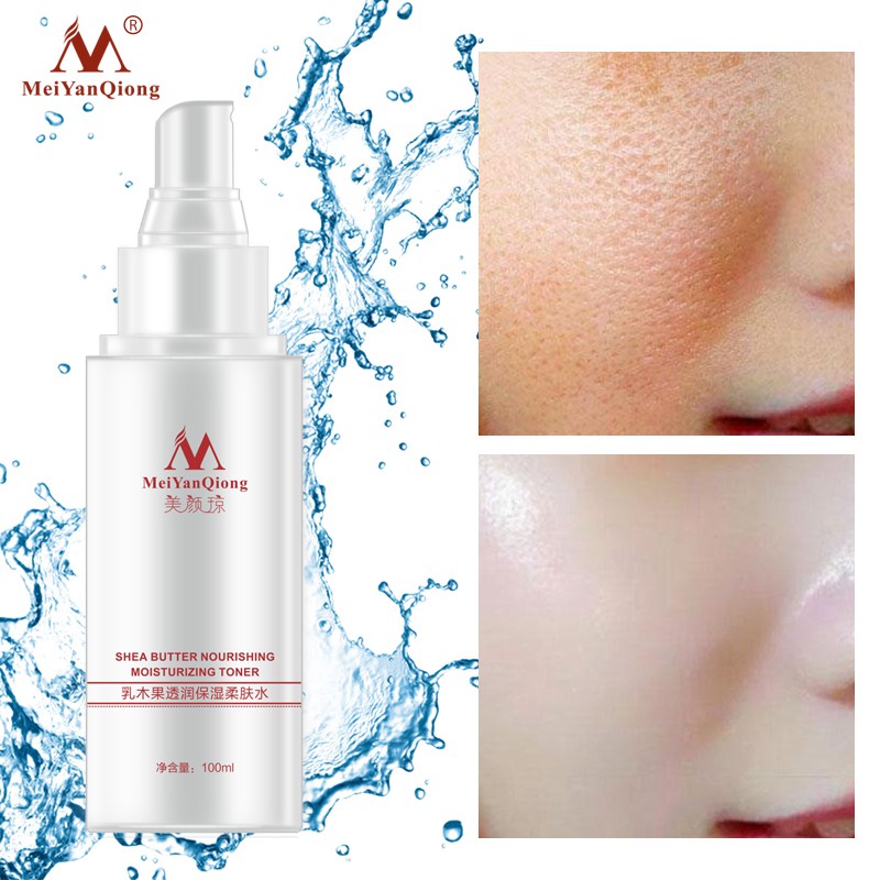 Nước Hoa Hồng MeiYanQiong Tinh Chất Bơ Hạt Mỡ Axit Hyaluronic Dưỡng Ẩm Làm Trắng Da 100ml