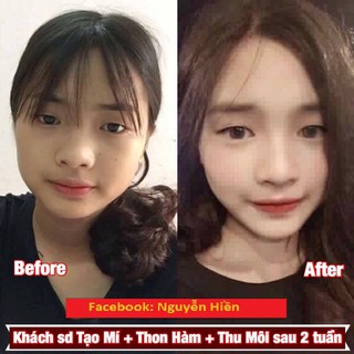 Tinh chất đầy môi, tạo môi trái tim