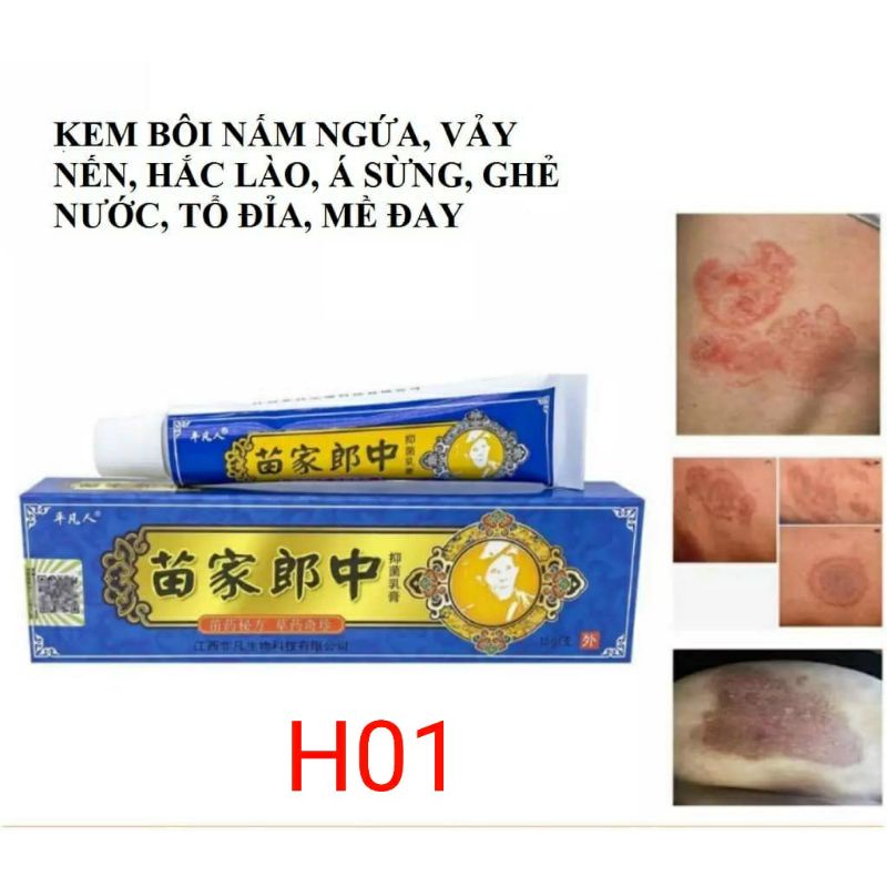 Kem bôi ngoài da hỗ trợ nấm ngứa, chàm, tổ đỉa, ghẻ nước - Có sẵn