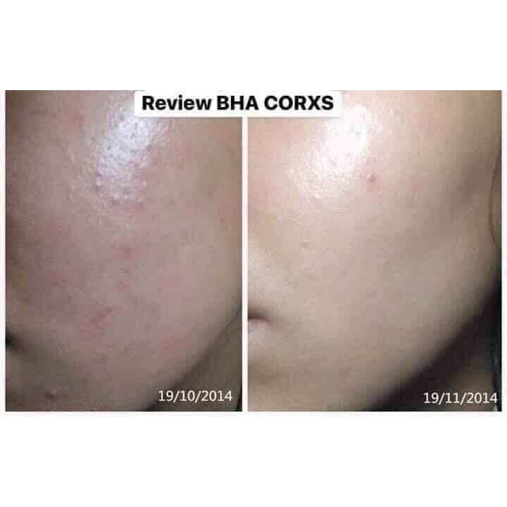 Nước hoa hồng AHA/BHA Cosrx 280ml