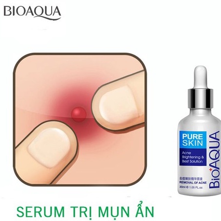 Serum Bioaqua Chuyên Ngừa Mụn BQY0726