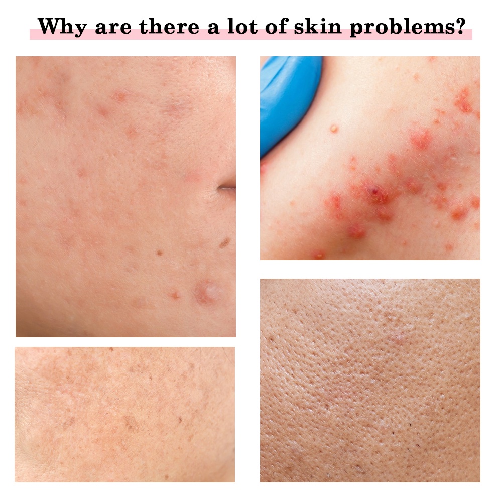 Máy Mát Xa Mặt MsDear Tích Hợp Đèn LED 5 Trong 1 Nâng Cơ Giúp Trẻ Hóa Da