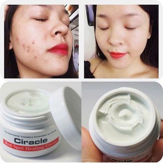 DATE 7.2025 KEM CHẤM MỤN CIRACLE RED SPOT HEALING CREAM