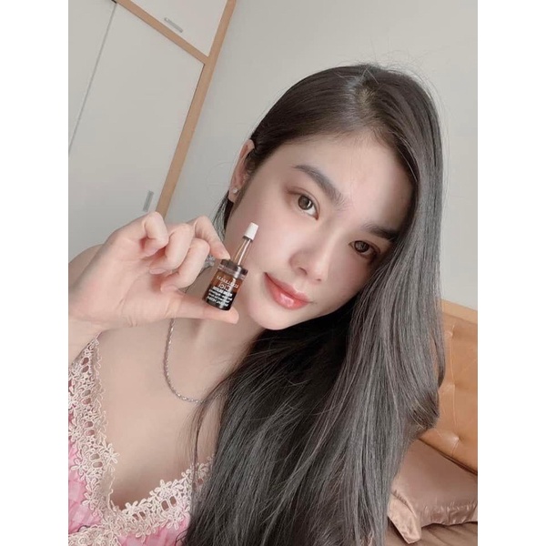HỘP SERUM MỤN🌱