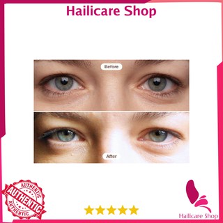 [Nhập Mỹ] Kem mắt RoC Retinol Correxion Eye Cream