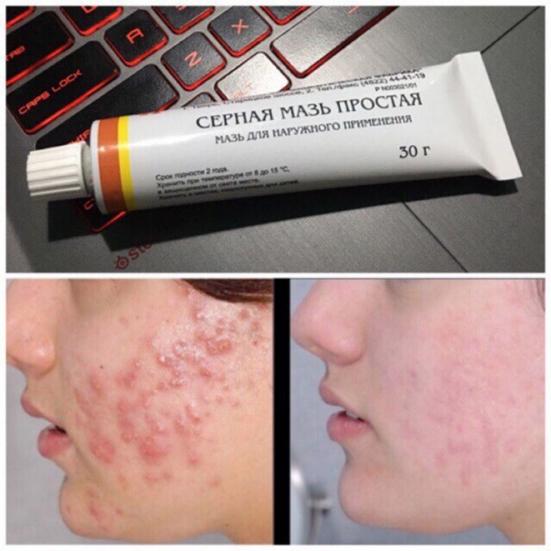 Kem lưu huỳnh Cephar