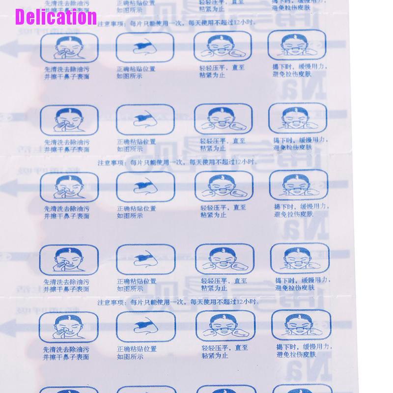 Set 50 Dụng Cụ Chống Ngáy Khi Ngủ Tiện Dụng