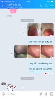 Combo 10 hủ mỡ trăn cao cấp phanan