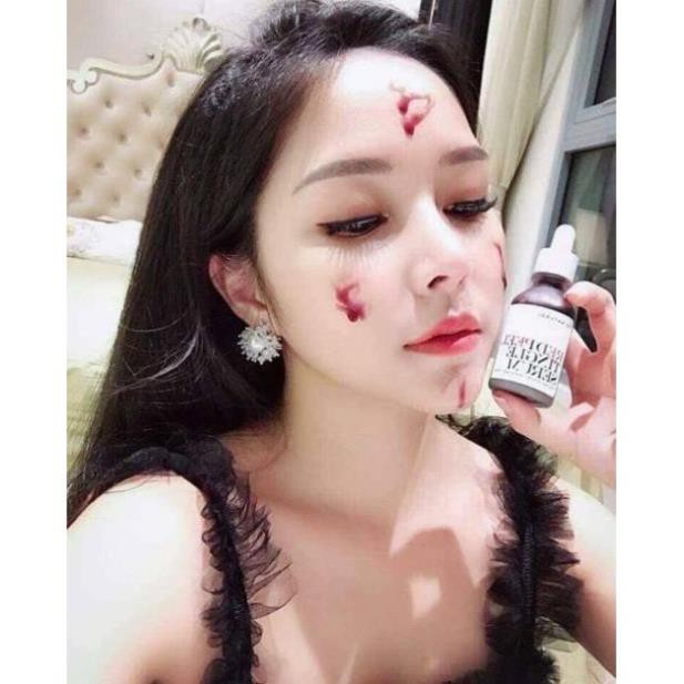 ✅  Sample  Red Peel Tingle Serum - Peel Da Không Bong Tróc
