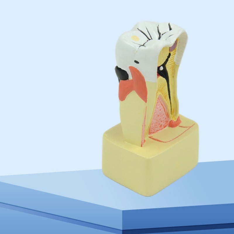 blg Dental Model Periodontal Disease Analysis for Dentist Teaching Dentistry Clinic