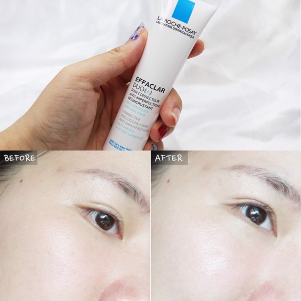 Kem mụn Effaclar DUO+ La Roche-Posay 40ml