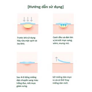 Miếng Dán Mụn SOME BY MI SPOT PATCH