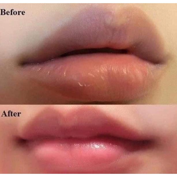 Tẩy tế bào chết Dành Cho Môi - Beauty Treats Lip Scrub 10g