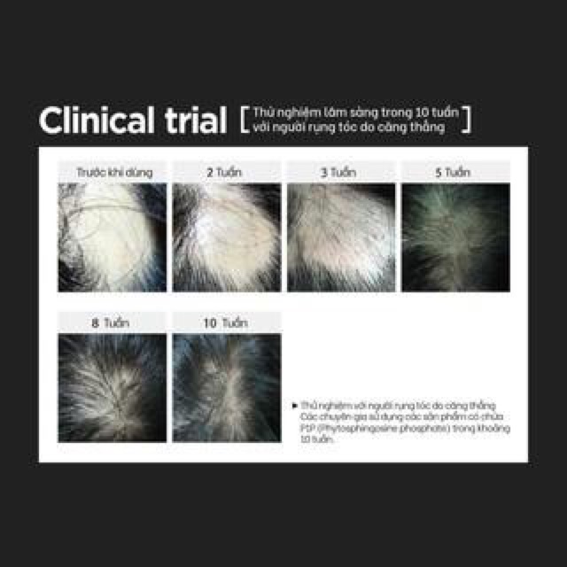 Tinh dầu kích mọc tóc TERAPIC Hàn Quốc Premium Total Hair Tonic- Sản phẩm tóc tốt nhất Hàn Quốc