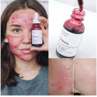 [Chính Hãng]  Tẩy da chết hóa học The Ordinary AHA 30% + BHA 2%