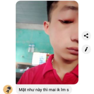 Gel Bôi Da Phú Kang