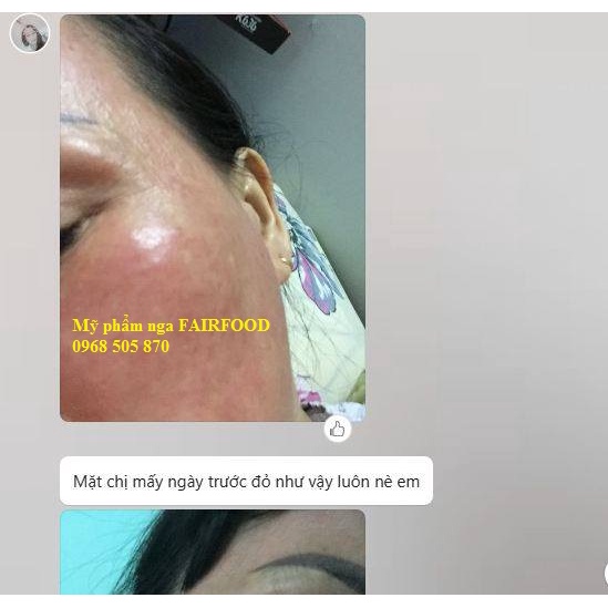 (ĐỎ,GÂN MÁU)Serum Lica Estetic Rosacea-Vein dưỡng da mỏng đỏ, nổi gân máu, quầng thâm, giãn tĩnh mạch | BigBuy360 - bigbuy360.vn