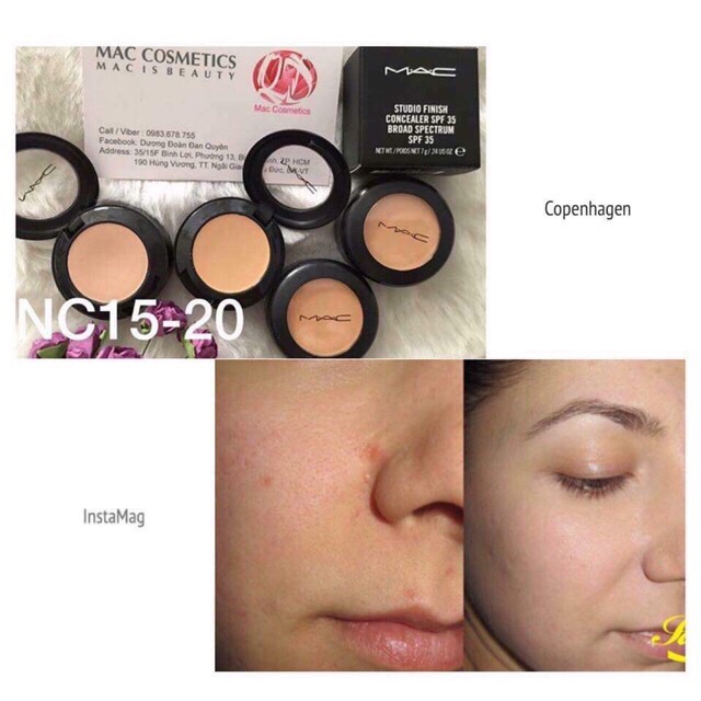 Che khuyết điểm MAC | BigBuy360 - bigbuy360.vn