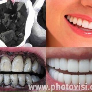 BỘT THAN TRE HOẠT TÍNH TRĂNG RĂNG ZENPALI ( Tặng 1tuyp kem đánh răng SENSODYNE )