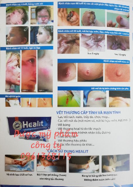 Kem liền vết thương nhanh, chống sẹo lõm HEALIT 5g | BigBuy360 - bigbuy360.vn