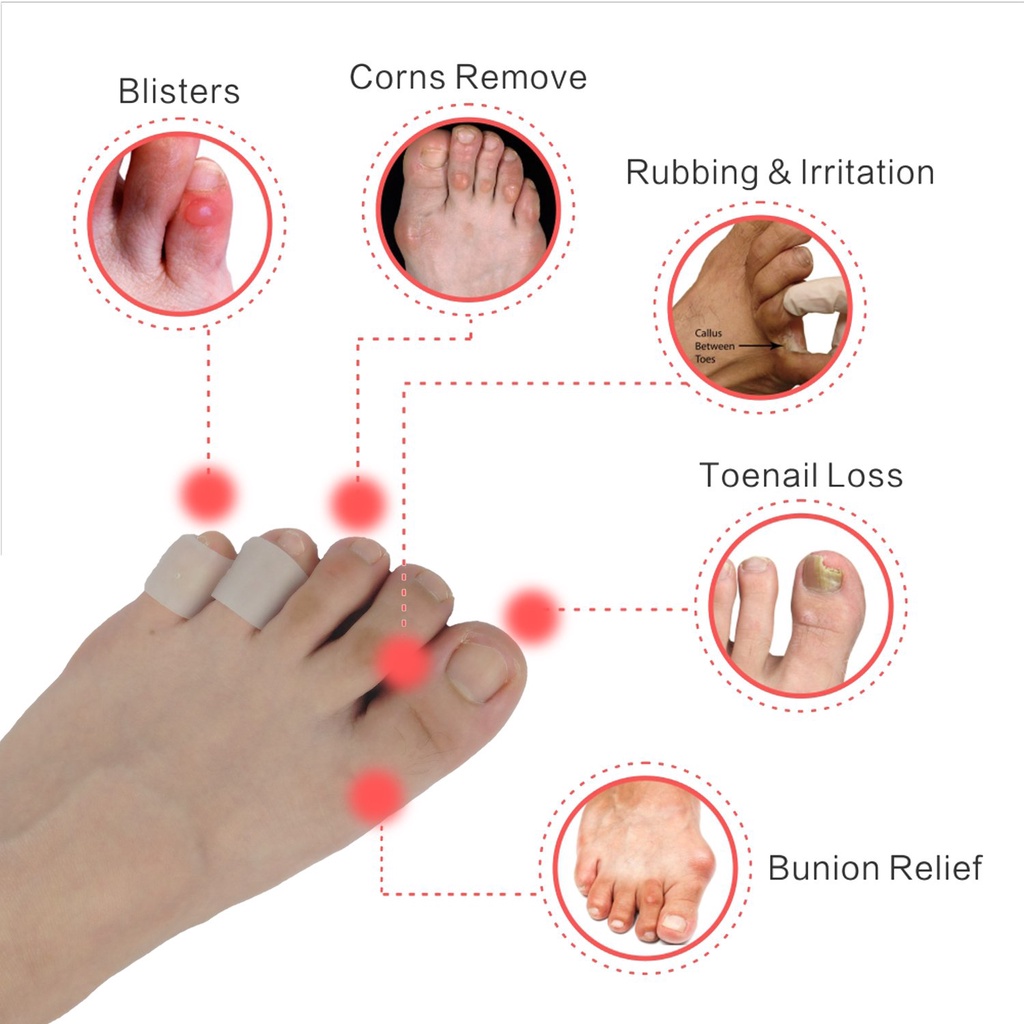 Gel Bảo Vệ Ngón Chân Thoáng Khí Giảm Đau Ma Sát